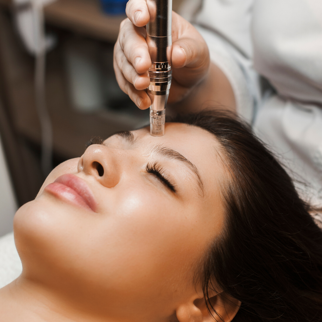 What is NANO Needling Infusion?