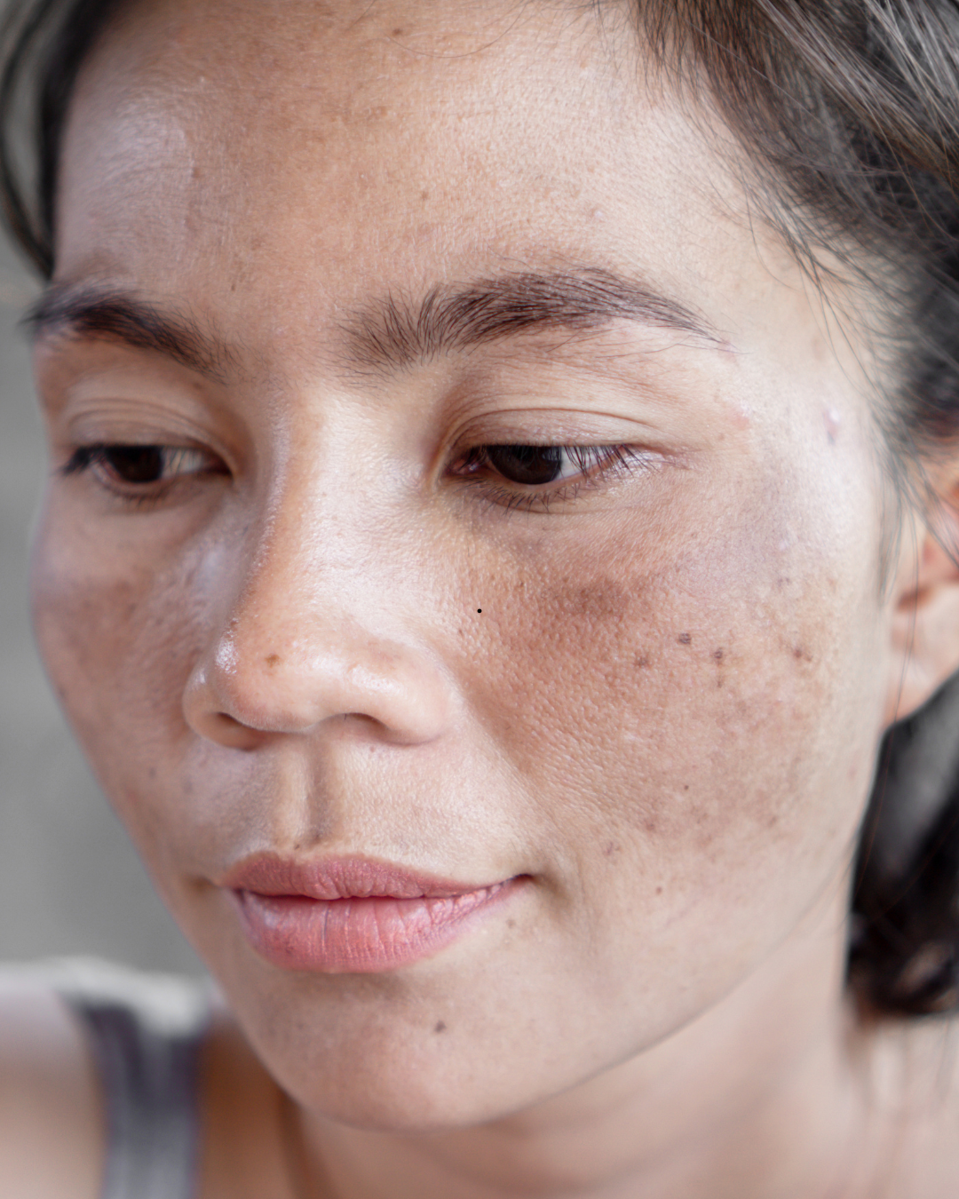 How to Treat Hyperpigmentation and Sun Damage Naturally with Plant-Based Skincare That Works
