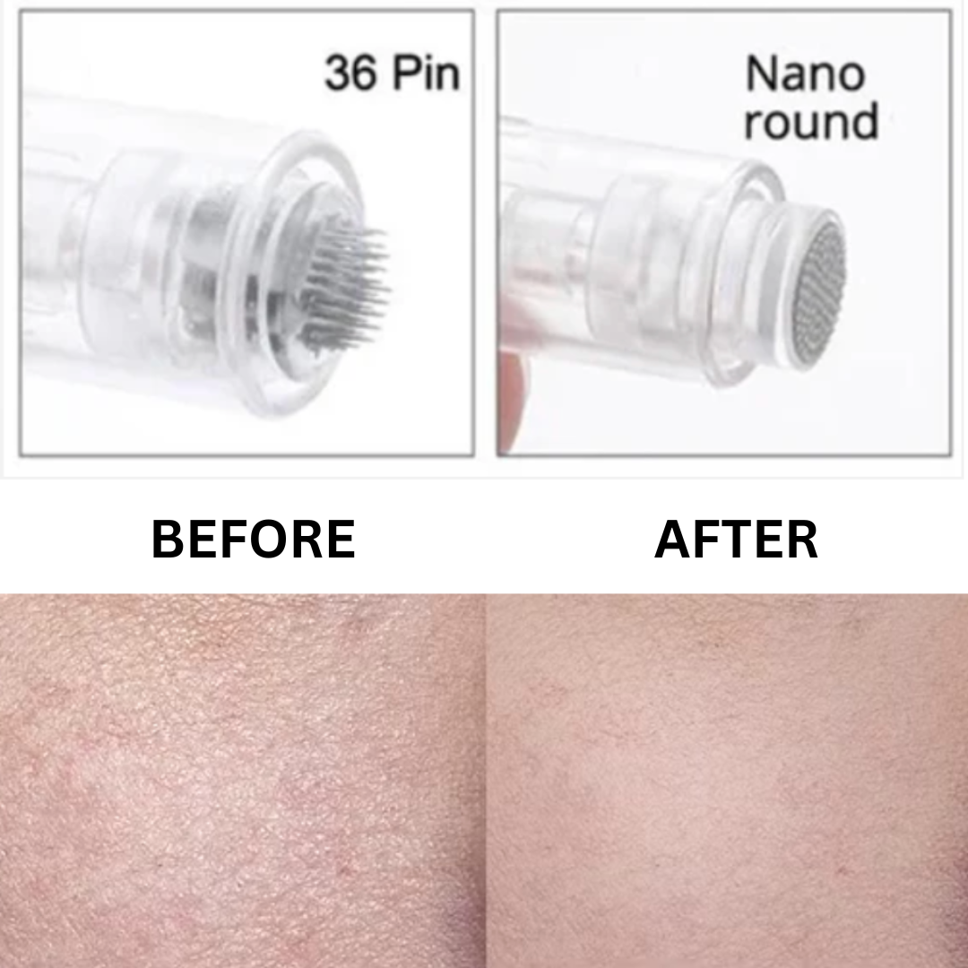 Cartridges Needles for Microneedling Pen | Precision Tip, Safe & Effective Skin Treatment for Anti-Aging