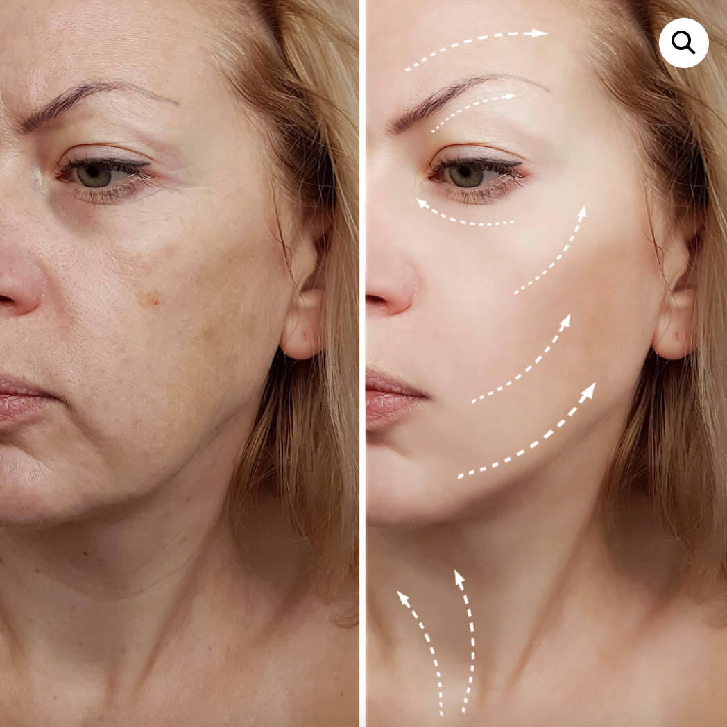 High Tech Copper Peptide Serum 10% | Advanced Anti-Aging, Skin Repair & Collagen Boosting Serum
