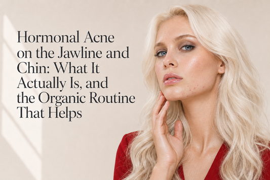 Hormonal Acne on the Jawline and Chin: What It Actually Is, and the Organic Routine That Helps