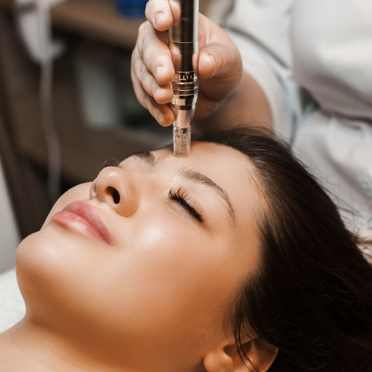 What is NANO Needling Infusion?