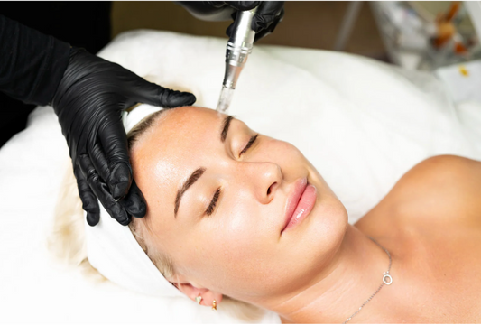 Professional microneedling facial treatment illustrating enhanced absorption of SNAP-8 peptides for wrinkle relaxation and collagen stimulation.