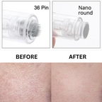 Cartridges Needles for Microneedling Pen | Precision Tip, Safe & Effective Skin Treatment for Anti-Aging