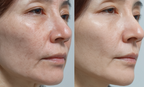 NAD+ Resveratrol Collagen Serum | Organic Anti-Aging Glow