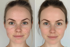 Retinol Bakuchiol Serum | Anti-Aging, Wrinkle-Reducing & Skin Firming Serum for Youthful Glow