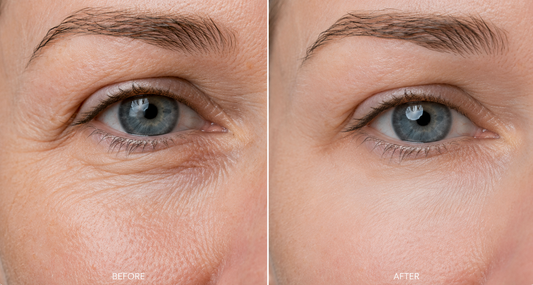 Super Peptide Eye Serum | Anti-Aging, Dark Circle & Puffiness Treatment for Youthful, Bright Eyes