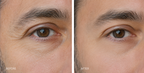 SÉRUM POUR LES YEUX SUPER PEPTIDIQUE