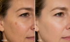 Super White Bio Serum | Skin Brightening, Anti-Aging & Hyperpigmentation Treatment for Radiant Complexion